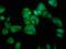 Serpin B4 antibody, LS-C671164, Lifespan Biosciences, Immunofluorescence image 