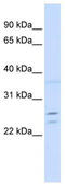 Tumor Protein D52 antibody, TA346595, Origene, Western Blot image 