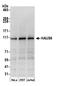 HAUS Augmin Like Complex Subunit 6 antibody, A305-457A, Bethyl Labs, Western Blot image 