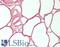 Apolipoprotein D antibody, LS-B12312, Lifespan Biosciences, Immunohistochemistry paraffin image 