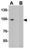 Itchy E3 Ubiquitin Protein Ligase antibody, GTX17213, GeneTex, Western Blot image 