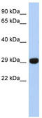 Fructosamine 3 Kinase Related Protein antibody, TA344259, Origene, Western Blot image 