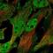 Cholinergic Receptor Nicotinic Delta Subunit antibody, NBP2-68725, Novus Biologicals, Immunofluorescence image 