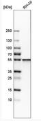 Serine Hydroxymethyltransferase 2 antibody, NBP1-80754, Novus Biologicals, Western Blot image 