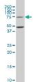 Ecdysoneless Cell Cycle Regulator antibody, H00011319-M02, Novus Biologicals, Western Blot image 