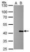 Proline And Serine Rich Coiled-Coil 1 antibody, NBP2-43790, Novus Biologicals, Western Blot image 