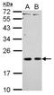 Carcinoembryonic Antigen Related Cell Adhesion Molecule 21 antibody, NBP2-15853, Novus Biologicals, Western Blot image 