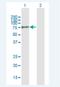 Polypeptide N-Acetylgalactosaminyltransferase 10 antibody, H00055568-B01P-50ug, Novus Biologicals, Western Blot image 