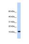 Transmembrane Protein 254 antibody, NBP1-69342, Novus Biologicals, Western Blot image 