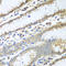 Protein Disulfide Isomerase Family A Member 3 antibody, LS-C331251, Lifespan Biosciences, Immunohistochemistry paraffin image 