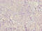 CD46 Molecule antibody, LS-C285469, Lifespan Biosciences, Immunohistochemistry paraffin image 