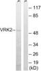 VRK Serine/Threonine Kinase 2 antibody, PA5-39445, Invitrogen Antibodies, Western Blot image 