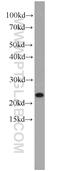 PEST Proteolytic Signal Containing Nuclear Protein antibody, 11180-2-AP, Proteintech Group, Western Blot image 