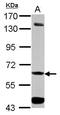 Aldehyde Dehydrogenase 7 Family Member A1 antibody, GTX103593, GeneTex, Western Blot image 