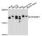 Eukaryotic Translation Initiation Factor 4E Binding Protein 1 antibody, MBS127113, MyBioSource, Western Blot image 