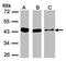 Sterol O-Acyltransferase 1 antibody, PA5-34676, Invitrogen Antibodies, Western Blot image 
