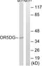 Olfactory Receptor Family 5 Subfamily D Member 16 antibody, A17569, Boster Biological Technology, Western Blot image 