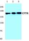 CF Transmembrane Conductance Regulator antibody, LS-B10424, Lifespan Biosciences, Western Blot image 