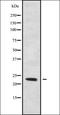 RAB6B, Member RAS Oncogene Family antibody, orb338631, Biorbyt, Western Blot image 
