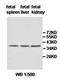 AlkB Homolog 4, Lysine Demethylase antibody, orb77979, Biorbyt, Western Blot image 