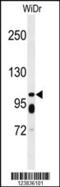 ATP Binding Cassette Subfamily C Member 11 antibody, 61-664, ProSci, Western Blot image 