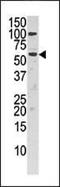 Choline Kinase Alpha antibody, PA5-15503, Invitrogen Antibodies, Western Blot image 