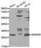 Synaptosome Associated Protein 25 antibody, A0986, ABclonal Technology, Western Blot image 
