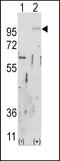 Fibroblast Growth Factor Receptor 2 antibody, LS-C97522, Lifespan Biosciences, Western Blot image 