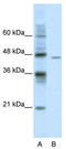 DEAD-Box Helicase 25 antibody, TA341587, Origene, Western Blot image 