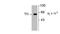 Tyrosine Hydroxylase antibody, TA309266, Origene, Western Blot image 