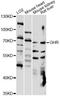 Growth Hormone Receptor antibody, LS-C749717, Lifespan Biosciences, Western Blot image 