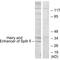 Hes Family BHLH Transcription Factor 6 antibody, A08067, Boster Biological Technology, Western Blot image 