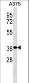 NSE1 Homolog, SMC5-SMC6 Complex Component antibody, LS-C158426, Lifespan Biosciences, Western Blot image 