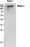Platelet Derived Growth Factor Receptor Alpha antibody, STJ95001, St John