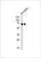 POTE ankyrin domain family member B antibody, 55-015, ProSci, Western Blot image 