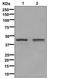 Glutamate-Ammonia Ligase antibody, M03191, Boster Biological Technology, Western Blot image 