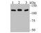 Heterogeneous Nuclear Ribonucleoprotein U antibody, A03691-2, Boster Biological Technology, Western Blot image 