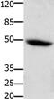 Colony Stimulating Factor 2 Receptor Alpha Subunit antibody, TA323989, Origene, Western Blot image 