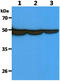 Fascin Actin-Bundling Protein 1 antibody, GTX57621, GeneTex, Western Blot image 