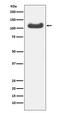 Heat Shock Protein Family A (Hsp70) Member 4 antibody, M03618, Boster Biological Technology, Western Blot image 