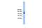 RNA Polymerase III Subunit B antibody, GTX46186, GeneTex, Western Blot image 
