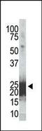 BCL2 Associated Agonist Of Cell Death antibody, MA5-11117, Invitrogen Antibodies, Western Blot image 