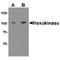 Hexokinase 1 antibody, TA349186, Origene, Western Blot image 