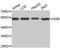 Small RNA Binding Exonuclease Protection Factor La antibody, A0630, ABclonal Technology, Western Blot image 