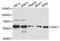 Dyskerin Pseudouridine Synthase 1 antibody, A12914, ABclonal Technology, Western Blot image 