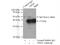 Nucleophosmin 1 antibody, 10306-1-AP, Proteintech Group, Immunoprecipitation image 