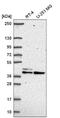 SET Domain And Mariner Transposase Fusion Gene antibody, NBP2-58313, Novus Biologicals, Western Blot image 