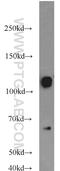 Calpastatin antibody, 12250-1-AP, Proteintech Group, Western Blot image 