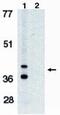 BCL2 Interacting Protein 3 Like antibody, PA1-12514, Invitrogen Antibodies, Western Blot image 