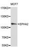 EPH Receptor A2 antibody, abx126898, Abbexa, Western Blot image 